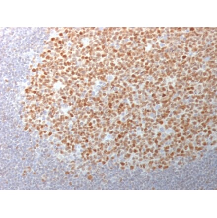 Immunohistochemistry - Anti-Bcl-6 Antibody [BCL6/1982] (A249900) - Antibodies.com
