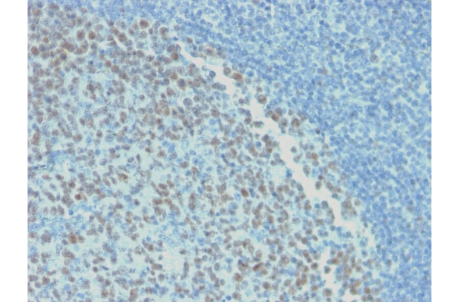 Immunohistochemistry - Anti-Bcl-6 Antibody [rBCL6/1718] (A249900) - Antibodies.com