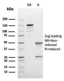 Recombinant Anti-Bcl-6 Antibody [rBCL6/1718] (A249901)