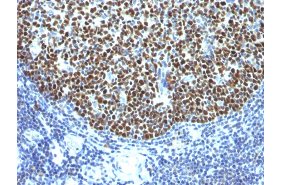 Immunohistochemistry - Anti-Bcl-6 Antibody [SPM602] (A249902) - Antibodies.com
