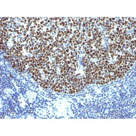 Immunohistochemistry - Anti-Bcl-6 Antibody [SPM602] (A249902) - Antibodies.com