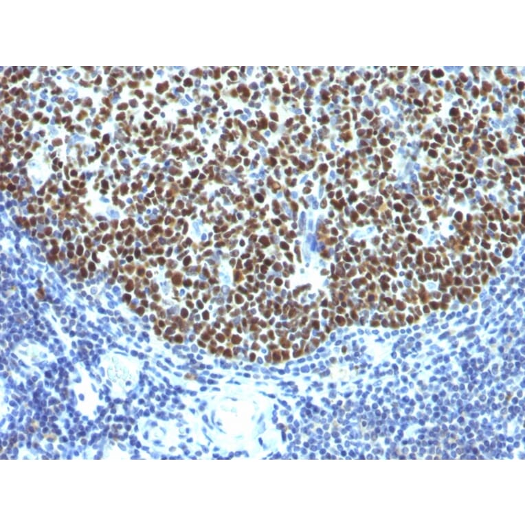 Immunohistochemistry - Anti-Bcl-6 Antibody [SPM602] (A249902) - Antibodies.com