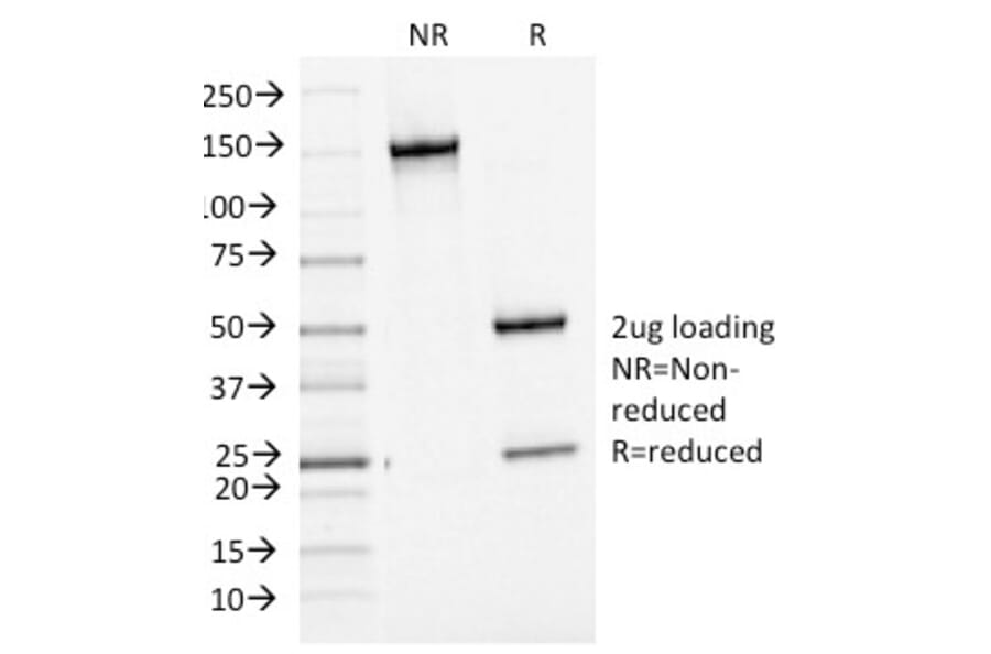 SDS-PAGE - Anti-Bcl-6 Antibody [BCL6/1475] (A249904) - Antibodies.com