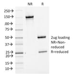 SDS-PAGE - Anti-Bcl-6 Antibody [BCL6/1475] (A249904) - Antibodies.com