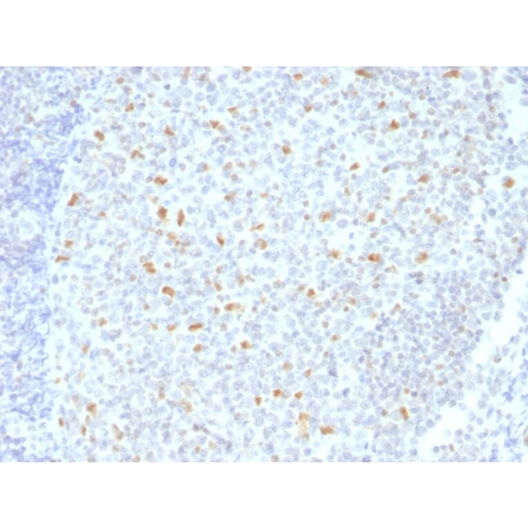 Immunohistochemistry - Anti-Bcl-6 Antibody [BCL6/1526] (A249905) - Antibodies.com