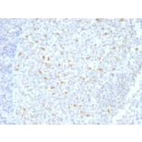 Immunohistochemistry - Anti-Bcl-6 Antibody [BCL6/1526] (A249905) - Antibodies.com