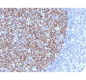 Immunohistochemistry - Anti-Bcl-6 Antibody [BCL6/1527] (A249906) - Antibodies.com