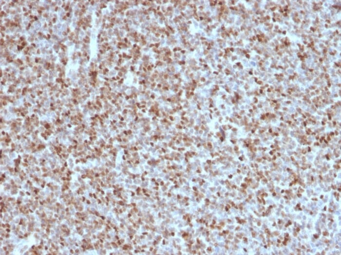 Anti-Bcl-6 Antibody [BCL6/1527] (A249906) | Antibodies.com