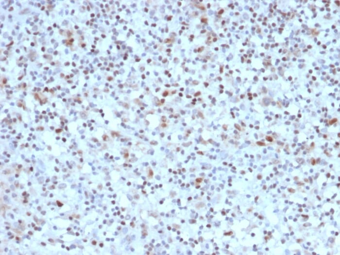Anti-Bcl-6 Antibody [BCL6/1527] (A249906) | Antibodies.com