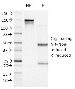 Anti-Bcl-6 Antibody [BCL6/1527] (A249906) | Antibodies.com