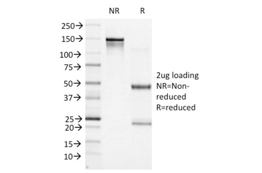 SDS-PAGE - Anti-Bcl-6 Antibody [BCL6/1527] (A249906) - Antibodies.com
