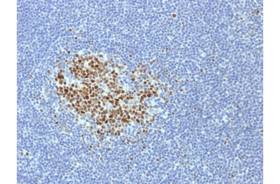 Immunohistochemistry - Anti-Bcl-6 Antibody [BCL6/1718] (A249907) - Antibodies.com