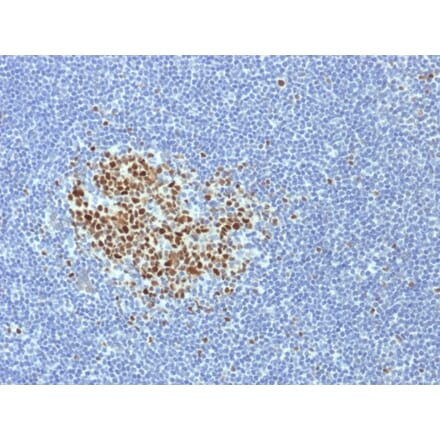 Immunohistochemistry - Anti-Bcl-6 Antibody [BCL6/1718] (A249907) - Antibodies.com