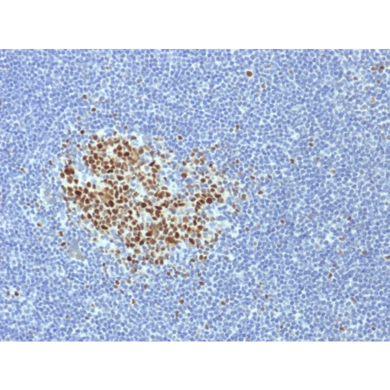 Immunohistochemistry - Anti-Bcl-6 Antibody [BCL6/1718] (A249907) - Antibodies.com