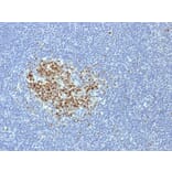 Immunohistochemistry - Anti-Bcl-6 Antibody [BCL6/1718] (A249907) - Antibodies.com
