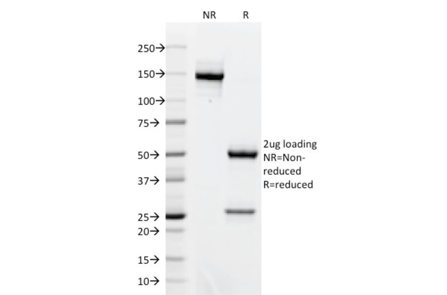 SDS-PAGE - Anti-Bcl-6 Antibody [BCL6/1718] (A249907) - Antibodies.com