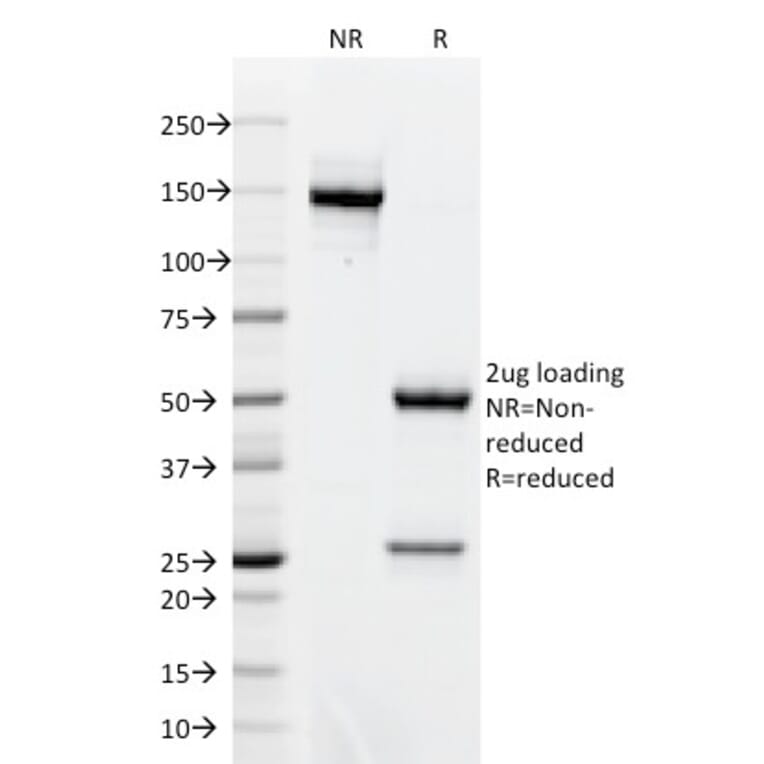 SDS-PAGE - Anti-Bcl-6 Antibody [BCL6/1718] (A249907) - Antibodies.com