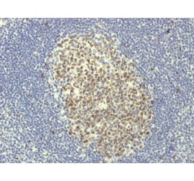 Immunohistochemistry - Anti-Bcl-6 Antibody [BCL6/1951R] (A249908) - Antibodies.com