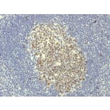 Immunohistochemistry - Anti-Bcl-6 Antibody [BCL6/1951R] (A249908) - Antibodies.com