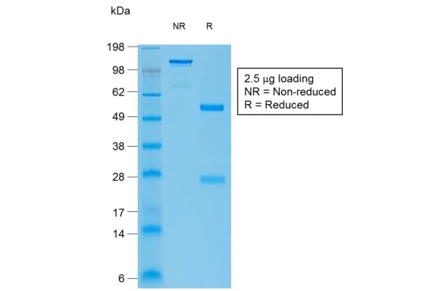 SDS-PAGE - Anti-Bcl-6 Antibody [BCL6/1951R] (A249908) - Antibodies.com