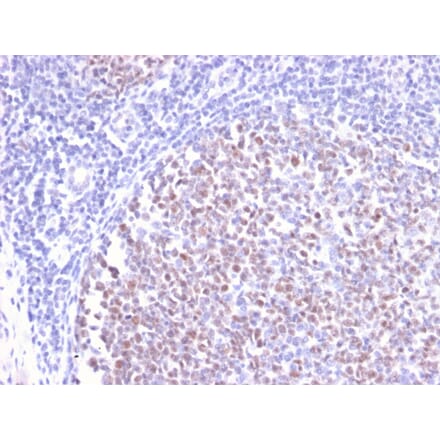 Immunohistochemistry - Anti-Bcl-6 Antibody [BCL6/2497R] (A249908) - Antibodies.com