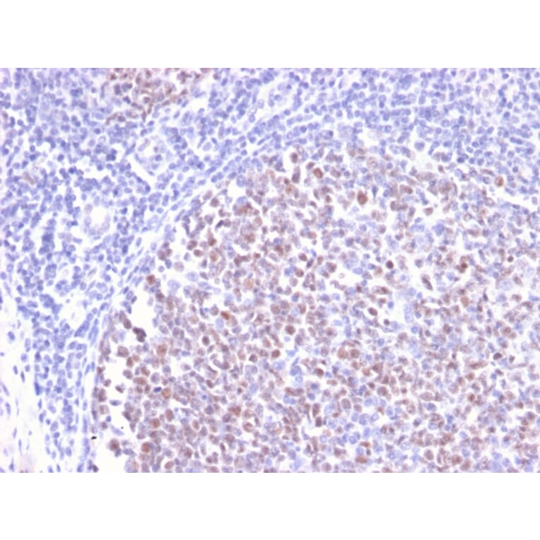 Immunohistochemistry - Anti-Bcl-6 Antibody [BCL6/2497R] (A249908) - Antibodies.com