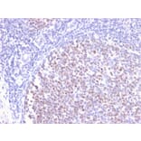Immunohistochemistry - Anti-Bcl-6 Antibody [BCL6/2497R] (A249908) - Antibodies.com
