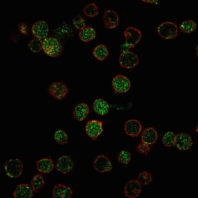 Immunofluorescence - Anti-ROR gamma Antibody [RORC/2941] (A249911) - Antibodies.com