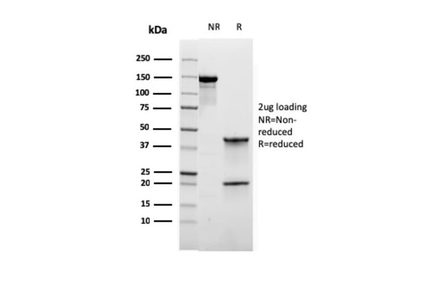SDS-PAGE - Anti-ROR gamma Antibody [RORC/2941] (A249911) - Antibodies.com