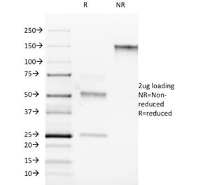 SDS-PAGE - Anti-ROR gamma Antibody [RORC/2942] (A249912) - Antibodies.com