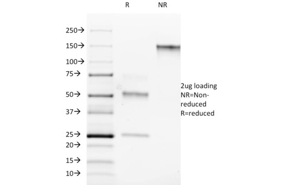 SDS-PAGE - Anti-ROR gamma Antibody [RORC/2942] (A249912) - Antibodies.com