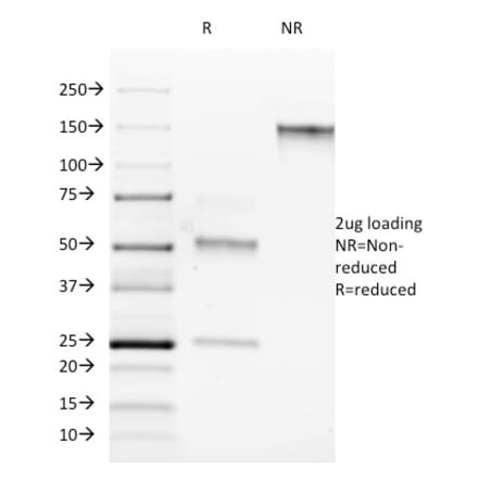 SDS-PAGE - Anti-ROR gamma Antibody [RORC/2942] (A249912) - Antibodies.com