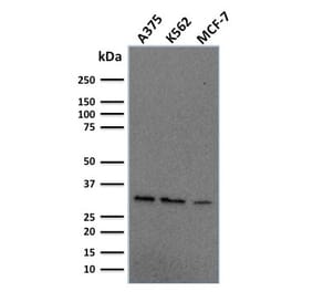 Western Blot - Anti-RPA2 Antibody [RPA2/2106] (A249913) - Antibodies.com