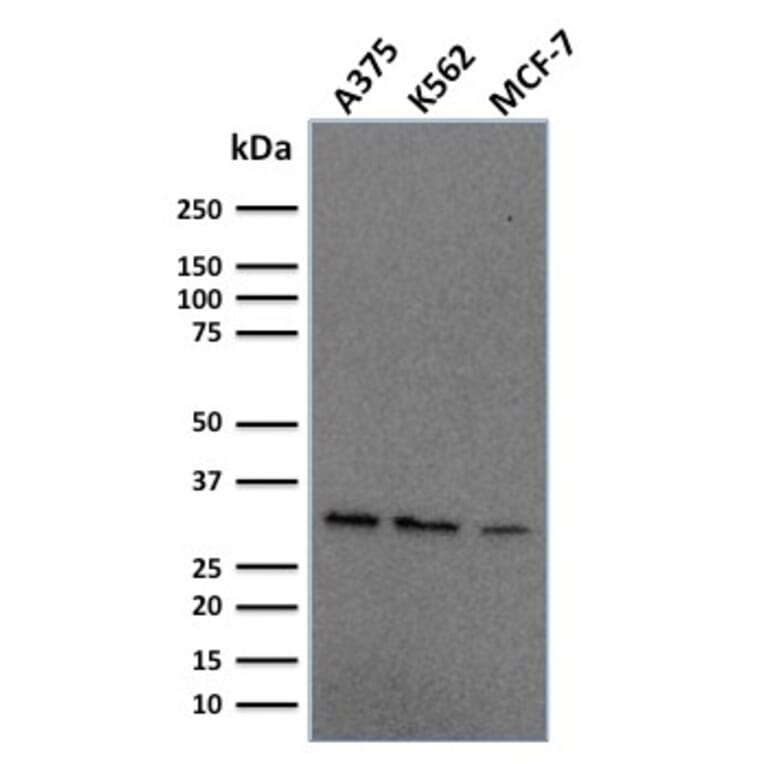 Western Blot - Anti-RPA2 Antibody [RPA2/2106] (A249913) - Antibodies.com
