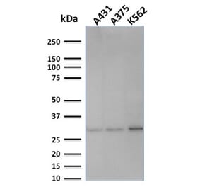 Western Blot - Anti-RPA2 Antibody [SPM316] (A249913) - Antibodies.com