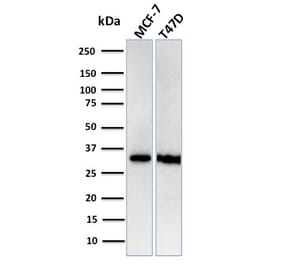 Western Blot - Anti-RPA2 Antibody [RPA2/3140R] (A249914) - Antibodies.com