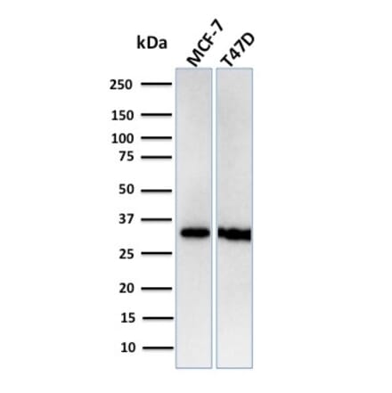 Western Blot - Anti-RPA2 Antibody [RPA2/3140R] (A249914) - Antibodies.com