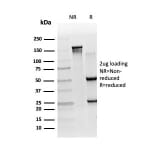 SDS-PAGE - Anti-RXRB Antibody [PCRP-RXRB-2B6] (A249916) - Antibodies.com
