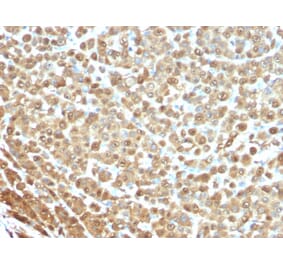 Immunohistochemistry - Anti-S100A1 Antibody [S1/61] (A249917) - Antibodies.com