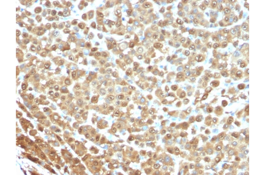 Immunohistochemistry - Anti-S100A1 Antibody [S1/61] (A249917) - Antibodies.com