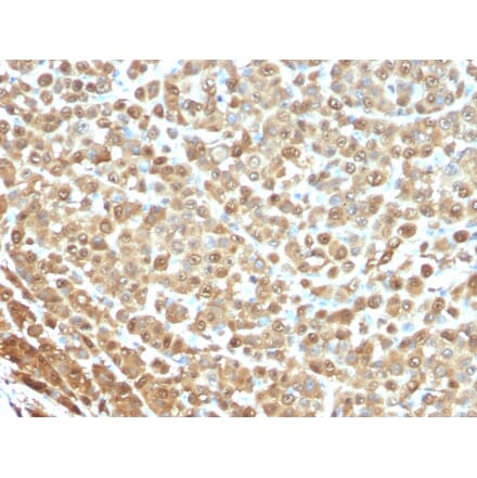 Immunohistochemistry - Anti-S100A1 Antibody [S1/61] (A249917) - Antibodies.com