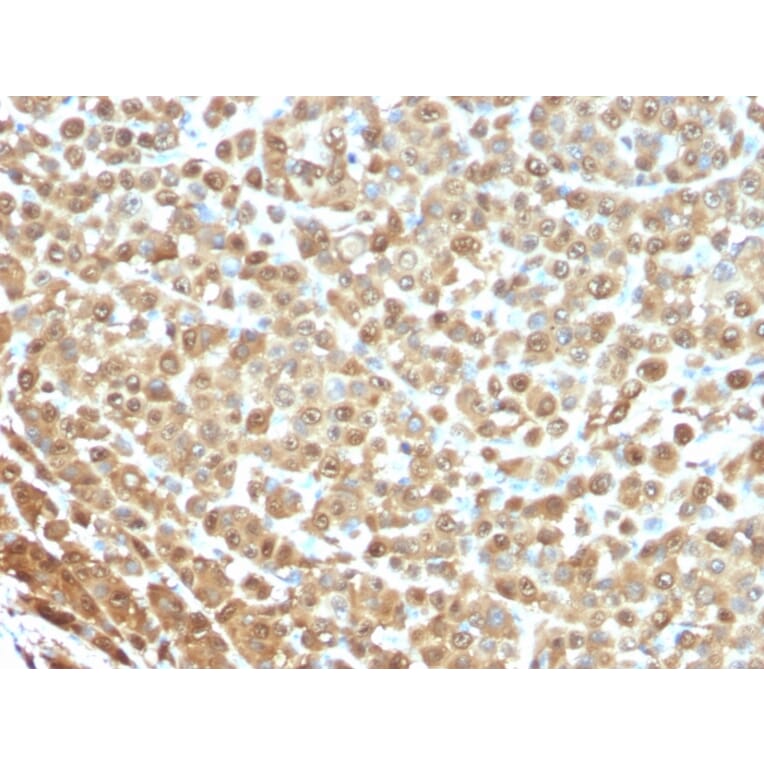 Immunohistochemistry - Anti-S100A1 Antibody [S1/61] (A249917) - Antibodies.com