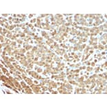 Immunohistochemistry - Anti-S100A1 Antibody [S1/61] (A249917) - Antibodies.com