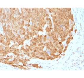 Immunohistochemistry - Anti-S100A1 Antibody [S100A1/1942] (A249918) - Antibodies.com