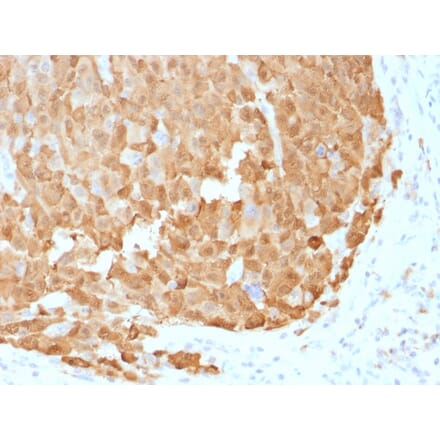 Immunohistochemistry - Anti-S100A1 Antibody [S100A1/1942] (A249918) - Antibodies.com