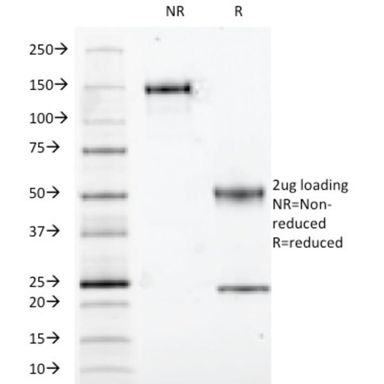 SDS-PAGE - Anti-S100A1 Antibody [S100A1/1942] (A249918) - Antibodies.com