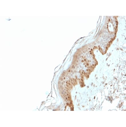 Immunohistochemistry - Anti-S100A2 Antibody [CPTC-S100A2-2] (A249919) - Antibodies.com