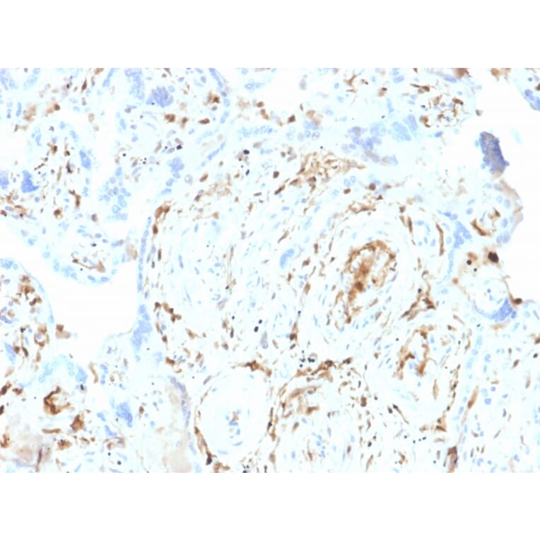 Immunohistochemistry - Anti-S100A2 Antibody [CPTC-S100A2-2] (A249919) - Antibodies.com