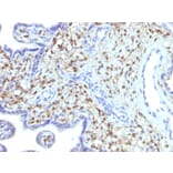 Immunohistochemistry - Anti-S100A4 Antibody [S100A4/1481] (A249920) - Antibodies.com
