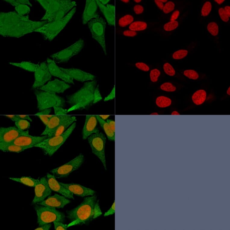 Immunofluorescence - Anti-S100A4 Antibody [S100A4/1481] (A249920) - Antibodies.com